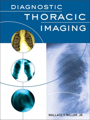 cover image of Diagnostic Thoracic Imaging